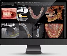 Clinical software DTX Studiodentalfor dental imagingmanagement