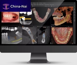 Clinical software DTX Studiodentalfor dental imagingmanagement