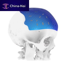 Custom-made cranial implant