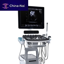 On-platform, compact ultrasound system Sonos 10for urology ultrasound imagingfor multipurpose ultrasound imagingfor gynecological and obstetric ultrasound imaging