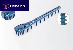 Humerus compression plate TRUE LOCK Proximal Humerusproximallockingmetallic