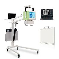 Digital mobile radiography unit YSDR-050