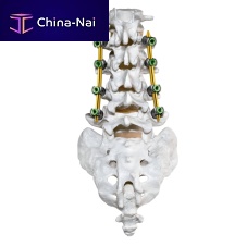 Minimally invasive pedicle screw positioning system CREO MIS®