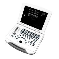 Portable ultrasound system HF-500for multipurpose ultrasound imagingB/Wbuilt-in console