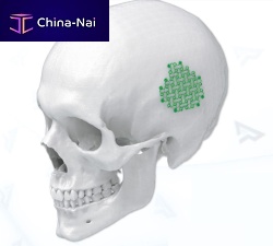 Non-absorbable cranial fixation system 4003008