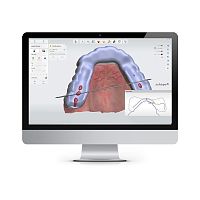 Control software SPLINT STUDIOdentalorthodontictreatment