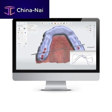 Control software SPLINT STUDIOdentalorthodontictreatment
