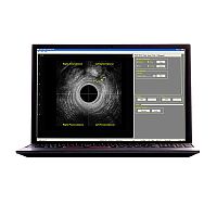 Portable ultrasound system (RTCU-S-N) Morpheus® 360� Endocavity US for gynecological and obstetric ultrasound imagingfor colorectal ultrasound imagingB/W