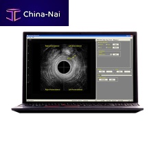 Portable ultrasound system (RTCU-S-N) Morpheus® 360� Endocavity US for gynecological and obstetric ultrasound imagingfor colorectal ultrasound imagingB/W