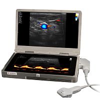 Portable ultrasound system UltraVision XSfor emergency medicine ultrasound imagingfor breast ultrasound imagingfor anesthetic and intensive care ultrasound imaging