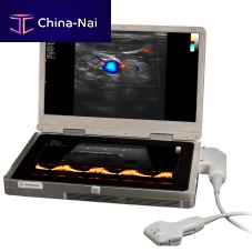 Portable ultrasound system UltraVision XSfor emergency medicine ultrasound imagingfor breast ultrasound imagingfor anesthetic and intensive care ultrasound imaging