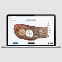 Dental software Dentbird CrowndesignCADscan