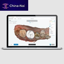 Dental software Dentbird CrowndesignCADscan