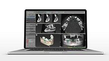Dental surgery software coDiagnostiXdentalfor dental implantologyplanning