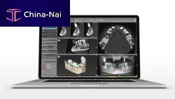 Dental surgery software coDiagnostiXdentalfor dental implantologyplanning