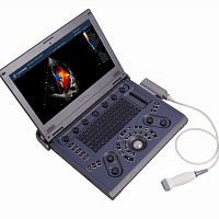 Color doppler ultrasound system C6 portablefor multipurpose ultrasound imagingB/W