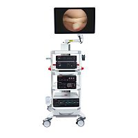 Arthroscopic endoscopy column Economy