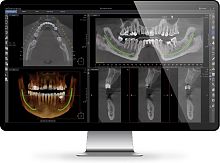 Medical software Xelis dentalreportingvisualization