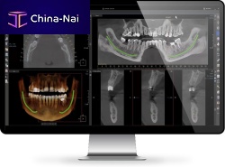Medical software Xelis dentalreportingvisualization