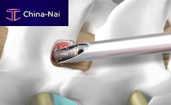 Spine surgery burr UDB-20-13-40diamondcutting