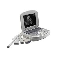Portable ultrasound system 3W-2200for multipurpose ultrasound imagingB/Wbuilt-in console