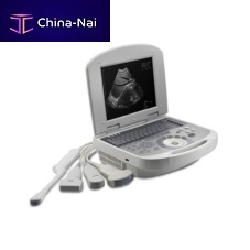 Portable ultrasound system 3W-2200for multipurpose ultrasound imagingB/Wbuilt-in console