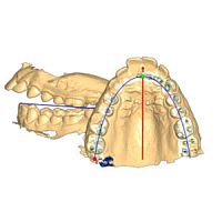 Dental software ORTH�UP analysisreportingCAD