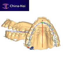 Dental software ORTH�UP analysisreportingCAD