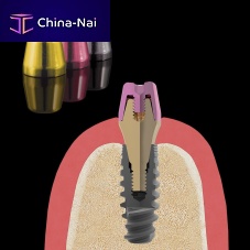 Multi-unit abutment healing cap