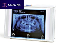 1-screen X-ray film viewer with switchdentalwhite light