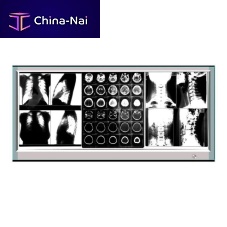 3-screen X-ray film viewer GP1003ALED