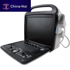 Portable ultrasound system TH-5000for gynecological and obstetric ultrasound imagingfor cardiovascular ultrasound imagingfor abdominal and pelvic ultrasound imaging