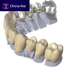 Dental software exocadCAD