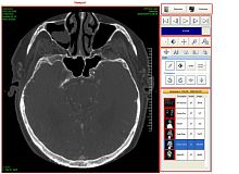 DICOM file software Ultima Digital Illuminatoroperating roomvisualizationdata exchange