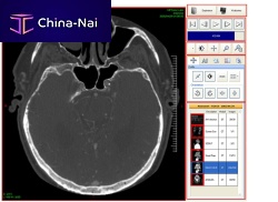 DICOM file software Ultima Digital Illuminatoroperating roomvisualizationdata exchange