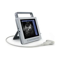 Portable ultrasound system YSB-K10for multipurpose ultrasound imagingfor gynecological and obstetric ultrasound imagingfor abdominal and pelvic ultrasound imaging