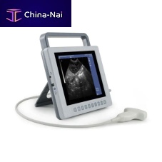Portable ultrasound system YSB-K10for multipurpose ultrasound imagingfor gynecological and obstetric ultrasound imagingfor abdominal and pelvic ultrasound imaging
