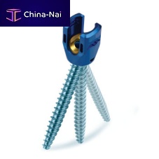 Lumbar-sacral vertebra pedicle screw REVERE® Uniplanarpolyaxialmetallic