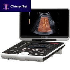 Portable ultrasound system MyLabOmega eXPfor multipurpose ultrasound imagingB/Wcolor doppler