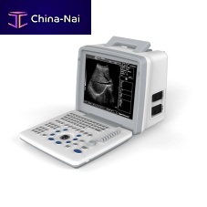Portable ultrasound system S300for multipurpose ultrasound imagingB/W12-inch