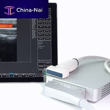 On-platform, tabletop ultrasound system ArtUsfor multipurpose ultrasound imagingB/Wcolor doppler