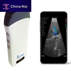 Hand-held ultrasound system SIFULTRAS-3.3for cardiovascular ultrasound imagingB/Wcolor doppler