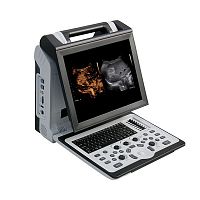 Portable ultrasound system Apogee 2300 Profor multipurpose ultrasound imagingfor urology ultrasound imagingfor musculoskeletal ultrasound imaging