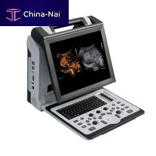 Portable ultrasound system Apogee 2300 Profor multipurpose ultrasound imagingfor urology ultrasound imagingfor musculoskeletal ultrasound imaging