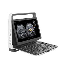 Portable ultrasound system YSB-M70for multipurpose ultrasound imagingB/Wcolor doppler