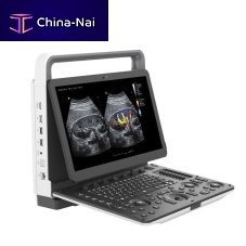 Portable ultrasound system YSB-M70for multipurpose ultrasound imagingB/Wcolor doppler
