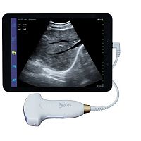 Hand-held ultrasound system UC5-2Sfor gynecological and obstetric ultrasound imagingfor abdominal and pelvic ultrasound imagingfor urology ultrasound imaging
