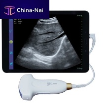 Hand-held ultrasound system UC5-2Sfor gynecological and obstetric ultrasound imagingfor abdominal and pelvic ultrasound imagingfor urology ultrasound imaging