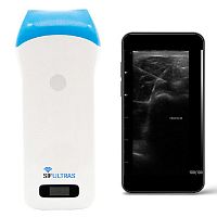 Portable ultrasound system SIFULTRAS-5.31for musculoskeletal ultrasound imagingB/Wcolor doppler