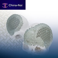 Custom-made cranial implant REAL FIT